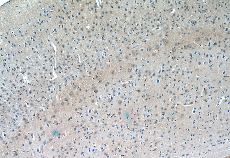 Immunohistochemistry of paraffin-embedded mouse brain tissue slide using Catalog No:109869(SLC6A3 Antibody) at dilution of 1:50 (under 10x lens)