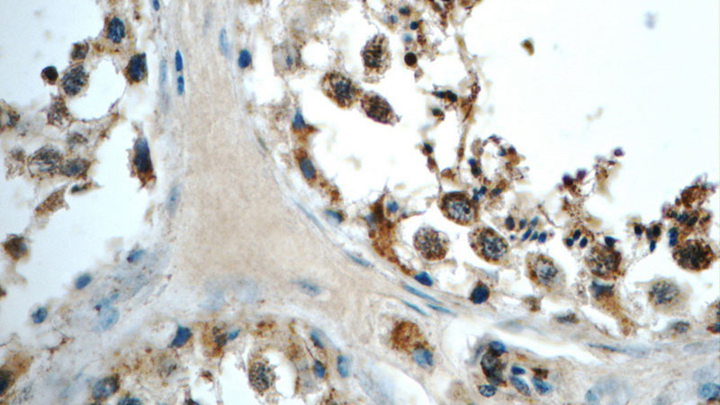 Immunohistochemistry of paraffin-embedded human testis tissue slide using Catalog No:115018(SCRG1 Antibody) at dilution of 1:50 (under 40x lens)