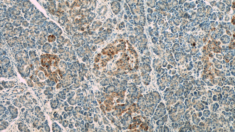 Immunohistochemistry of paraffin-embedded human pancreas slide using Catalog No:112334(LRRC47 Antibody) at dilution of 1:50