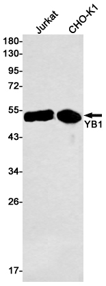 Western blot detection of YB1 in Jurkat,Hela cell lysates using YB1 Rabbit mAb(1:1000 diluted).Predicted band size:36kDa.Observed band size:49kDa.