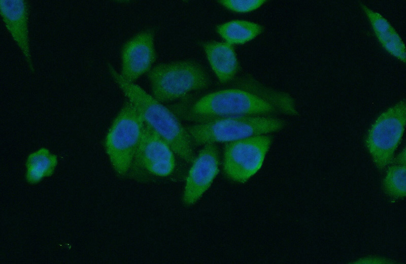 Immunofluorescent analysis of (10% Formaldehyde) fixed HeLa cells using Catalog No:114412(RAB12 Antibody) at dilution of 1:50 and Alexa Fluor 488-congugated AffiniPure Goat Anti-Rabbit IgG(H+L)