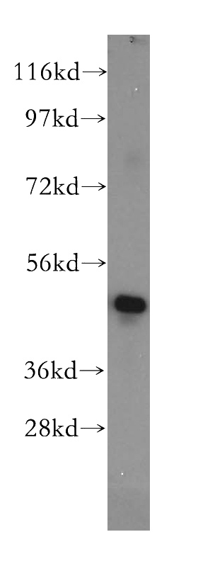 Jurkat cells were subjected to SDS PAGE followed by western blot with Catalog No:113472(PA2G4 antibody) at dilution of 1:2000