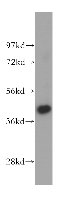 human testis tissue were subjected to SDS PAGE followed by western blot with Catalog No:116270(TMOD2 antibody) at dilution of 1:400
