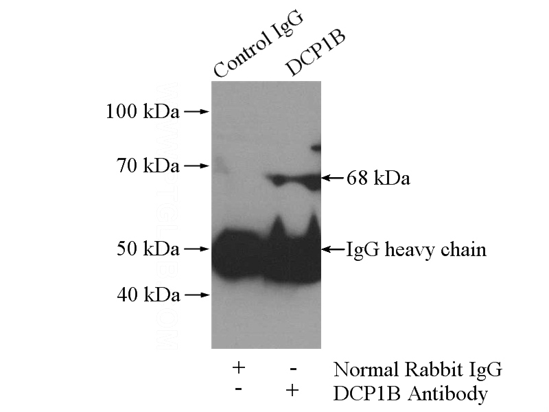 IP Result of anti-DCP1B (IP:Catalog No:109755, 4ug; Detection:Catalog No:109755 1:500) with HeLa cells lysate 1520ug.
