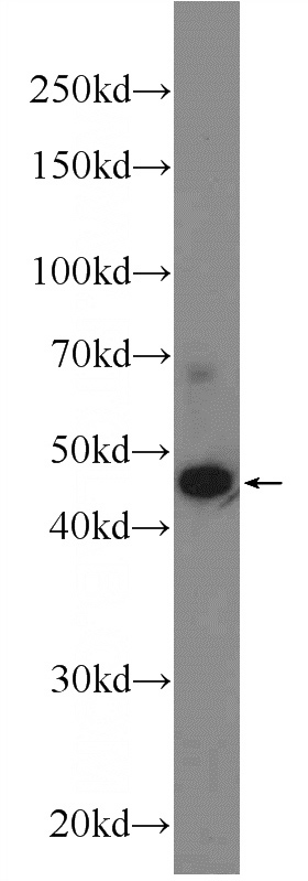 Jurkat cells were subjected to SDS PAGE followed by western blot with Catalog No:107996(AMMECR1 Antibody) at dilution of 1:600