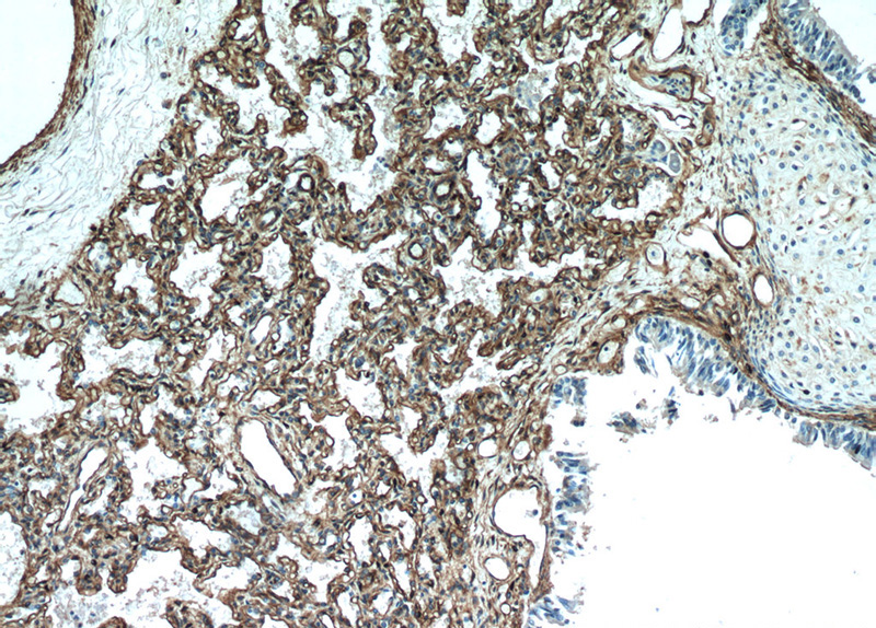 Immunohistochemical of paraffin-embedded human lung using Catalog No:108895(CAV1 antibody) at dilution of 1:50 (under 10x lens)