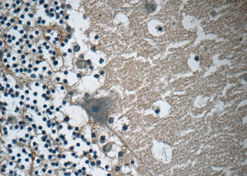 Immunohistochemistry of paraffin-embedded human cerebellum tissue slide using Catalog No:107996(AMMECR1 Antibody) at dilution of 1:50 (under 40x lens)