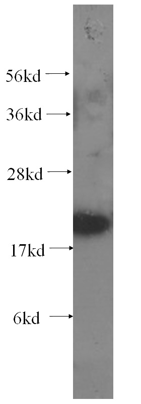 human adrenal gland tissue were subjected to SDS PAGE followed by western blot with Catalog No:107491(RAB18 antibody) at dilution of 1:1000