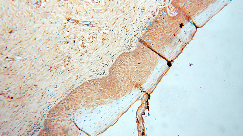 Immunohistochemical of paraffin-embedded human cervix using Catalog No:112265(LACTB2 antibody) at dilution of 1:100 (under 10x lens)