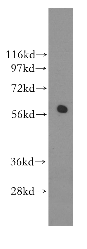 mouse testis tissue were subjected to SDS PAGE followed by western blot with Catalog No:114512(RAD23A antibody) at dilution of 1:500