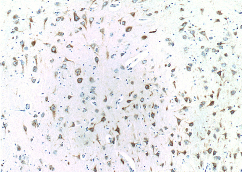 Immunohistochemistry of paraffin-embedded human brain tissue slide using Catalog No:110350(EPHA6 Antibody) at dilution of 1:200 (under 10x lens)