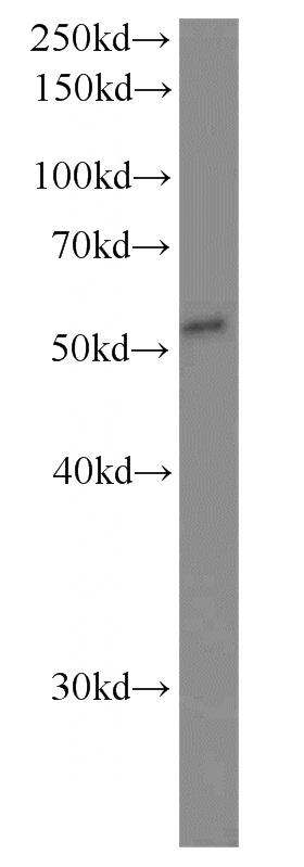 mouse brain tissue were subjected to SDS PAGE followed by western blot with Catalog No:110449(FADS1 antibody) at dilution of 1:1000