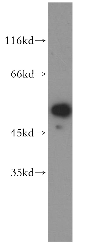 HeLa cells were subjected to SDS PAGE followed by western blot with Catalog No:113583(PARD6B antibody) at dilution of 1:500