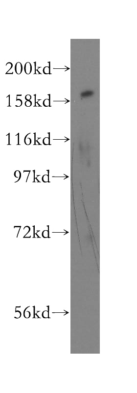 HeLa cells were subjected to SDS PAGE followed by western blot with Catalog No:110514(FANCA antibody) at dilution of 1:800