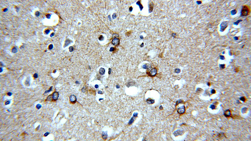 Immunohistochemical of paraffin-embedded human brain using Catalog No:113561(NGFR antibody) at dilution of 1:50 (under 40x lens)
