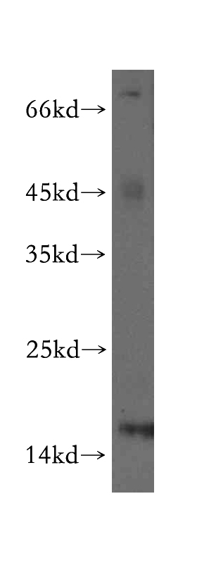 A549 cells were subjected to SDS PAGE followed by western blot with Catalog No:111035(GLRX2 antibody) at dilution of 1:200