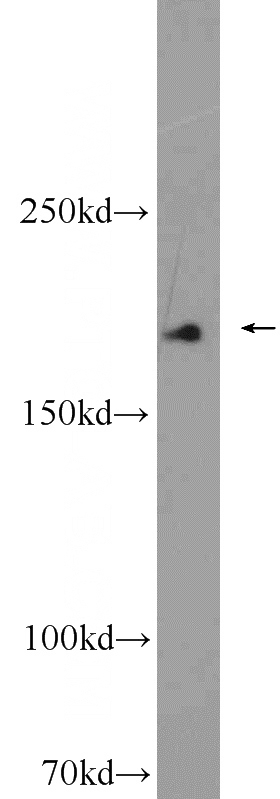 human blood tissue were subjected to SDS PAGE followed by western blot with Catalog No:107877(A2M antibody) at dilution of 1:6000