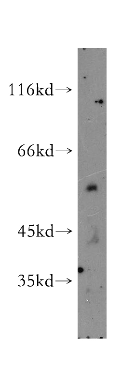 NIH/3T3 cells were subjected to SDS PAGE followed by western blot with Catalog No:115425(SMAP1 antibody) at dilution of 1:1000