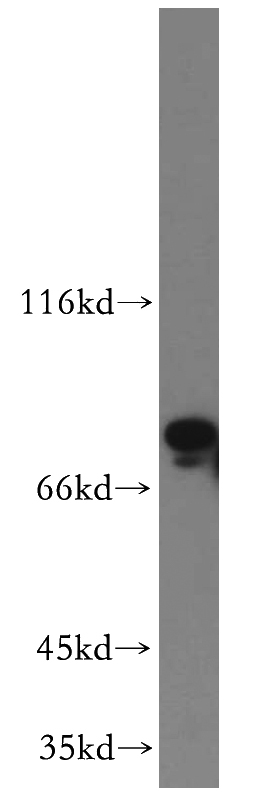 mouse testis tissue were subjected to SDS PAGE followed by western blot with Catalog No:114762(RNF6 antibody) at dilution of 1:800