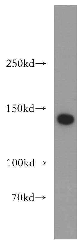HeLa cells were subjected to SDS PAGE followed by western blot with Catalog No:115438(SMC3 antibody) at dilution of 1:300