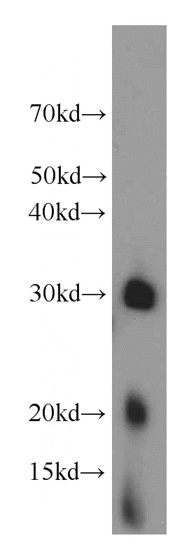 mouse brain tissue were subjected to SDS PAGE followed by western blot with Catalog No:112847(MRPS2 antibody) at dilution of 1:3000