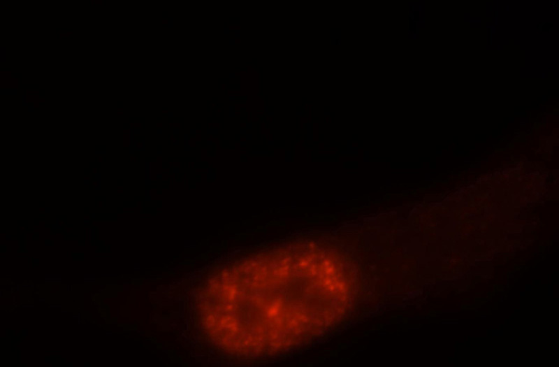Immunofluorescent analysis of A2780 cells, using PTBP1 antibody Catalog No:114259 at 1:25 dilution and Rhodamine-labeled goat anti-rabbit IgG (red).