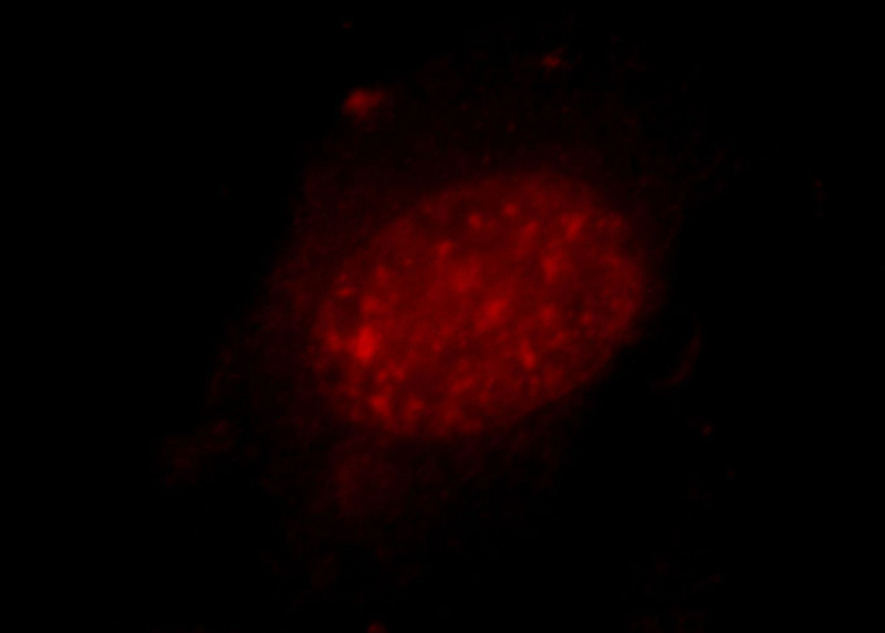 Immunofluorescent analysis of Hela cells, using ZXDC antibody Catalog No:117273 at 1:25 dilution and Rhodamine-labeled goat anti-rabbit IgG (red).