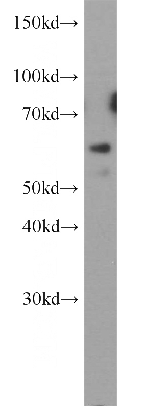 HeLa cells were subjected to SDS PAGE followed by western blot with Catalog No:111575(HYAL2 antibody) at dilution of 1:800
