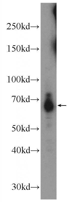 mouse kidney tissue were subjected to SDS PAGE followed by western blot with Catalog No:111073(GPR108 antibody) at dilution of 1:600