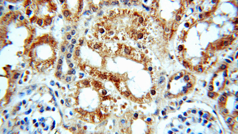 Immunohistochemical of paraffin-embedded human kidney using Catalog No:113921(PKNOX2 antibody) at dilution of 1:50 (under 40x lens)