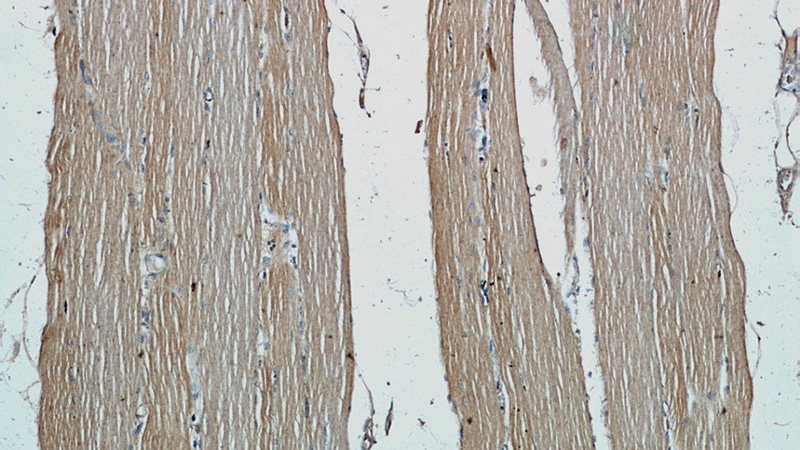 Immunohistochemistry of paraffin-embedded human skeletal muscle slide using Catalog No:109199(CFLAR Antibody) at dilution of 1:50