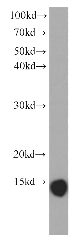 human heart tissue were subjected to SDS PAGE followed by western blot with Catalog No:107285(GAL1,LGALS1 antibody) at dilution of 1:1000