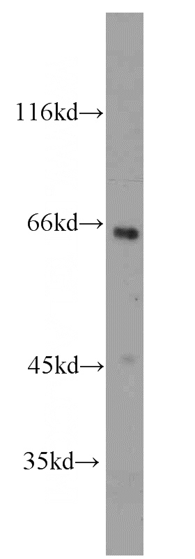 HeLa cells were subjected to SDS PAGE followed by western blot with Catalog No:115181(NSP1;SH2D3A antibody) at dilution of 1:1000