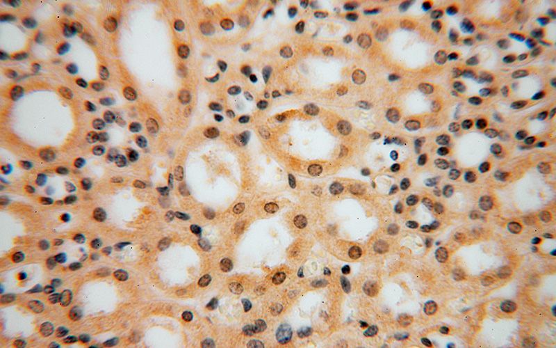 Immunohistochemical of paraffin-embedded human kidney using Catalog No:114092(PPP1R8 antibody) at dilution of 1:50 (under 40x lens)