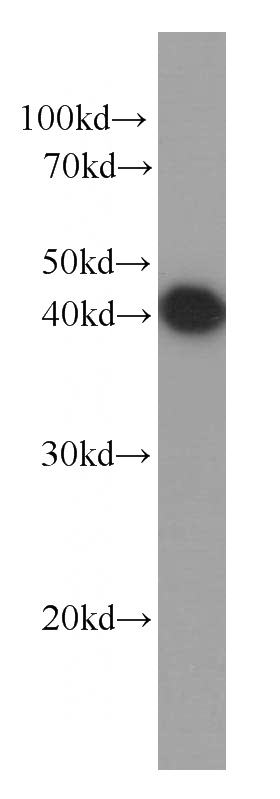HEK-293 cells were subjected to SDS PAGE followed by western blot with Catalog No:107461(PDHA1 antibody) at dilution of 1:20000