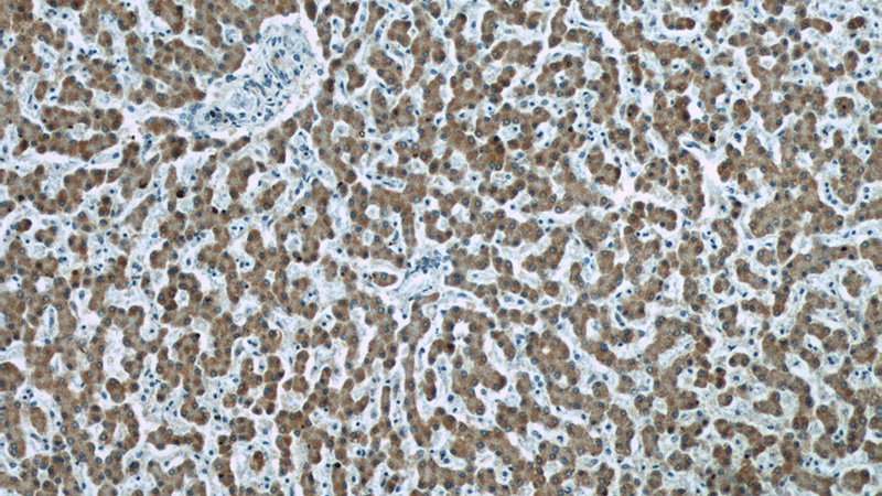 Immunohistochemistry of paraffin-embedded human liver tissue slide using Catalog No:107245(ECHS1 Antibody) at dilution of 1:50