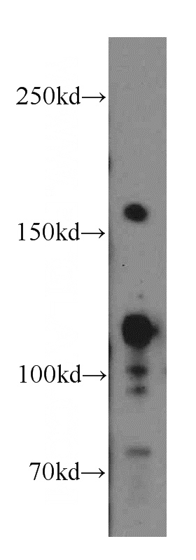 HeLa cells were subjected to SDS PAGE followed by western blot with Catalog No:113042(NCOA3 antibody) at dilution of 1:300