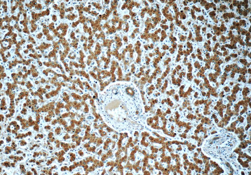 Immunohistochemistry of paraffin-embedded human liver tissue slide using Catalog No:115573(SPINK9 Antibody) at dilution of 1:50 (under 10x lens)