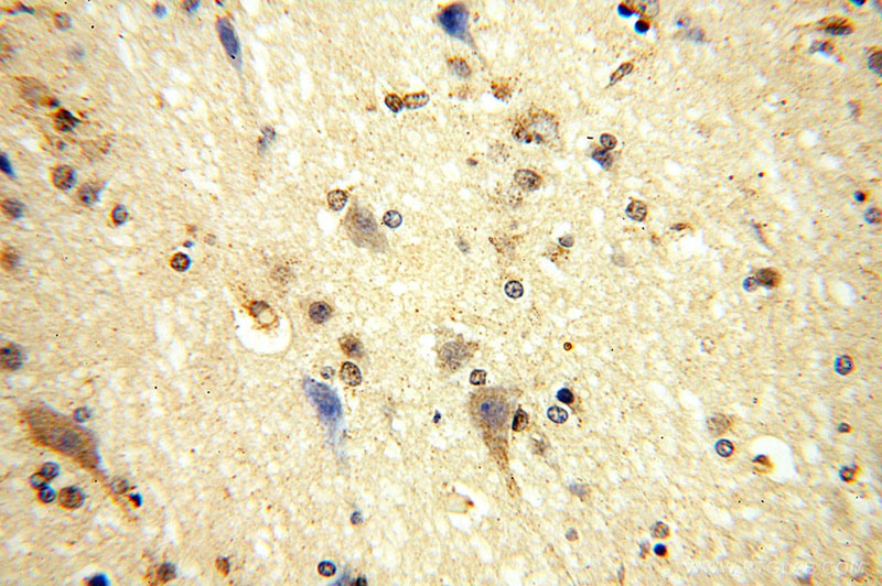 Immunohistochemical of paraffin-embedded human brain using Catalog No:111582(IARS2 antibody) at dilution of 1:100 (under 40x lens)