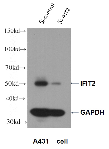 WB result of IFIT2 antibody (Catalog No:111619, 1:300) with si-IFIT2 and si-Control transfected A431 cells.