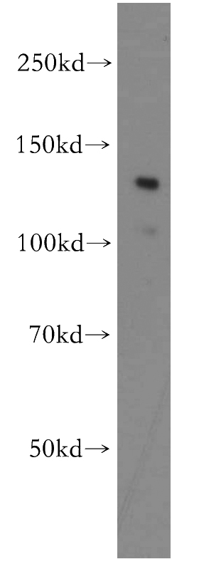HEK-293 cells were subjected to SDS PAGE followed by western blot with Catalog No:108128(APAF1 antibody) at dilution of 1:500