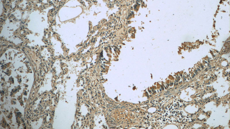 Immunohistochemistry of paraffin-embedded human lung slide using Catalog No:112659(MEPE Antibody) at dilution of 1:50 (under 10x lens)
