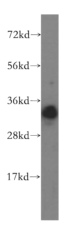 human liver tissue were subjected to SDS PAGE followed by western blot with Catalog No:114729(RNASEH2A antibody) at dilution of 1:500