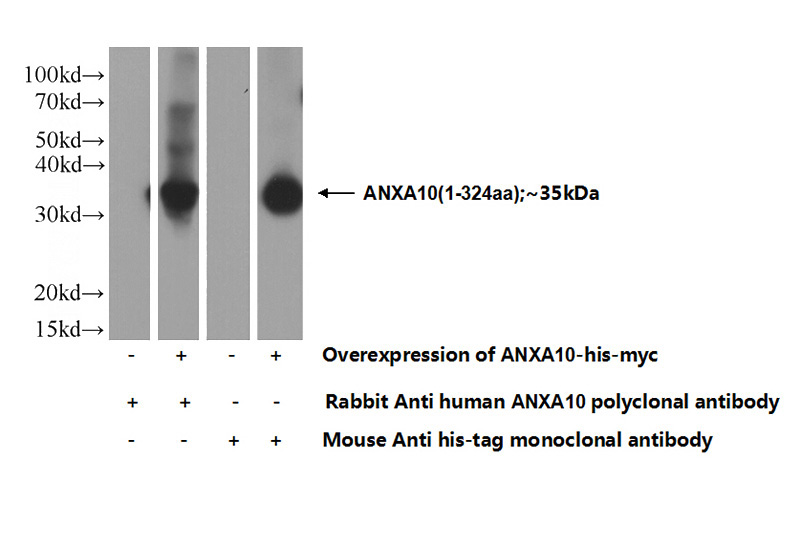 Transfected HEK-293 cells were subjected to SDS PAGE followed by western blot with Catalog No:108090(ANXA10 Antibody) at dilution of 1:1000