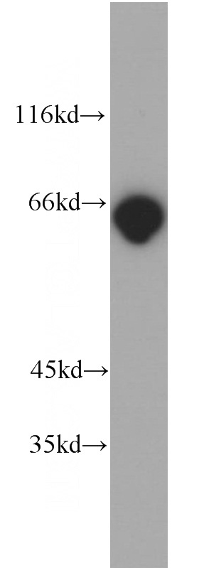 HeLa cells were subjected to SDS PAGE followed by western blot with Catalog No:113559(p65 antibody) at dilution of 1:1000