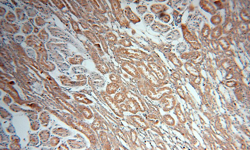 Immunohistochemical of paraffin-embedded human kidney using Catalog No:110525(FARSA antibody) at dilution of 1:100 (under 10x lens)
