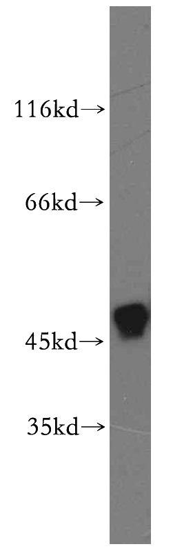 K-562 cells were subjected to SDS PAGE followed by western blot with Catalog No:111645(IKBKG antibody) at dilution of 1:800