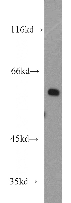 Jurkat cells were subjected to SDS PAGE followed by western blot with Catalog No:115709(STIP1 antibody) at dilution of 1:800