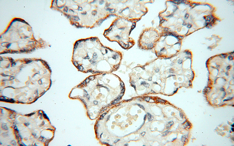 Immunohistochemical of paraffin-embedded human placenta using Catalog No:116140(TIMP2 antibody) at dilution of 1:50 (under 40x lens)