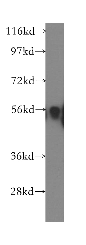 human kidney tissue were subjected to SDS PAGE followed by western blot with Catalog No:111815(IP6K1 antibody) at dilution of 1:300